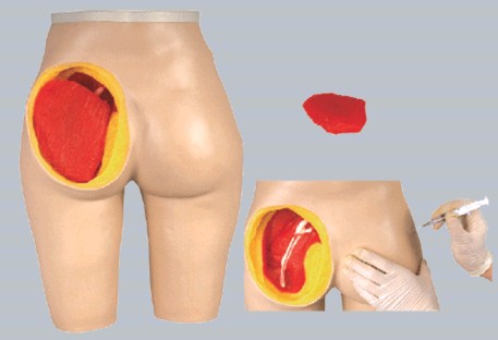 高级臀部肌肉注射与解剖结构模型