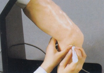 肘关节腔内注射模型