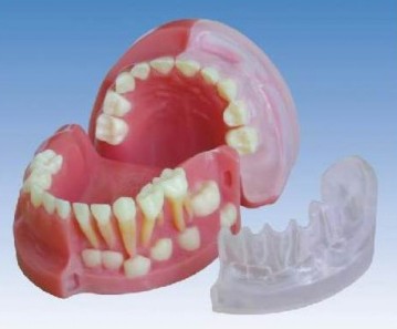 三岁乳恒牙交替解剖模型