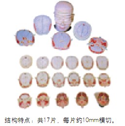 人体头颈部断层解剖横切面模型